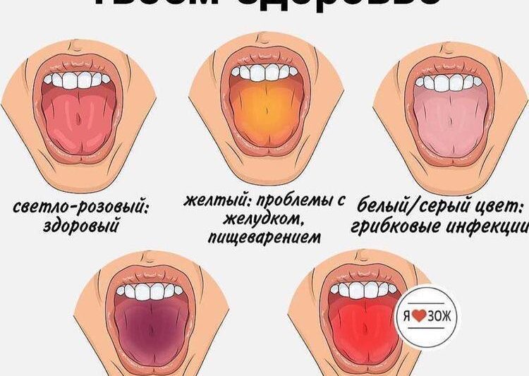 Диагностика по цвету: о чем говорит цвет языка ?#заботимся_о_здоровьеПолезные со…