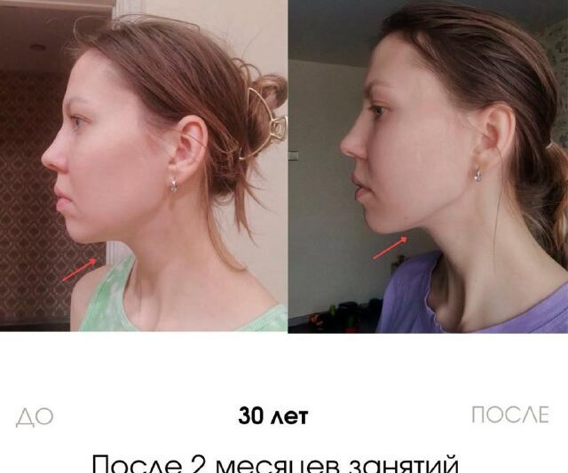 Жвачка избавит от 2-го подбородка?Каждая вторая девушка стесняется второго подб…