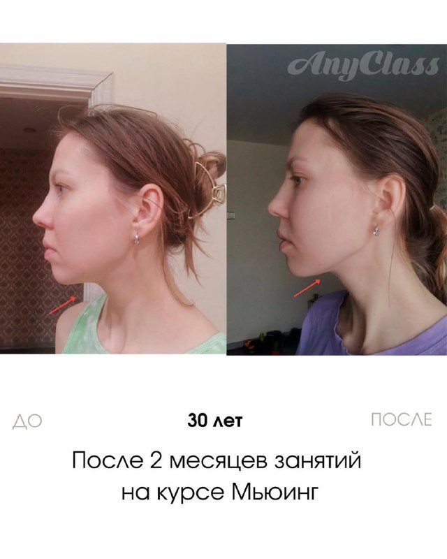 Жвачка избавит от 2-го подбородка?Каждая вторая девушка стесняется второго подб...